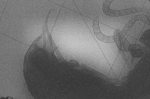 X-ray device with high spatial resolution