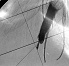 X-ray device with high spatial resolution