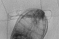 X-ray device with high spatial resolution